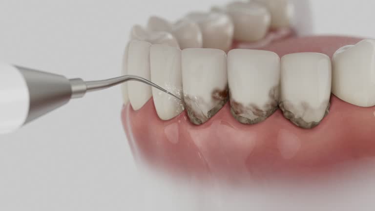 Reliable Dental contractor in Bucyrus, OH by Dentist Open Now